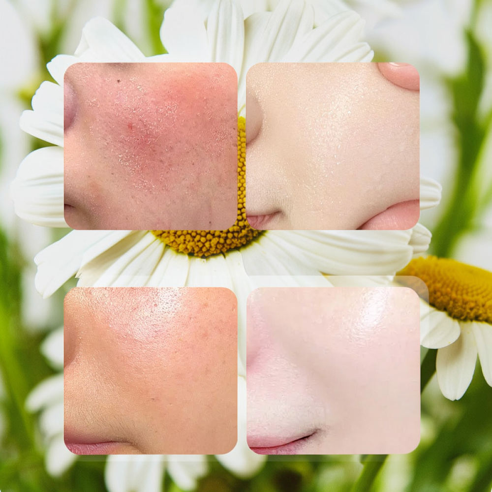 Face Mask Skincare - Fykly Rose VC Papatya B5 Vitaminli