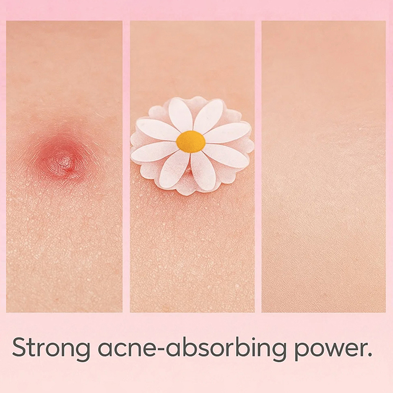 100 adet Yüz Cilt Bakımı Sivil - Skincare China incelemesi ve fiyatı